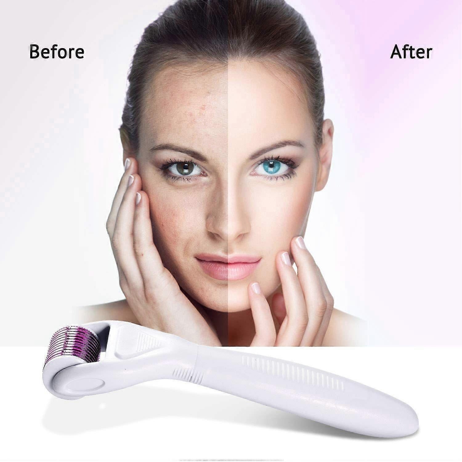 Dermaroller rola dermatologica 4 in 1 cu ace din otel inoxidabil