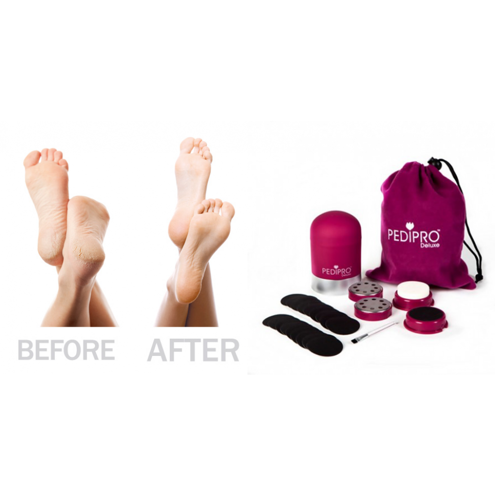 Oferta Set 2x - Aparat pentru ingrijirea picioarelor
