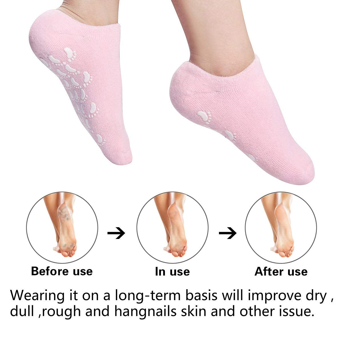Sosete Hidradante cu gel reparator, SpaGel Marime Universala