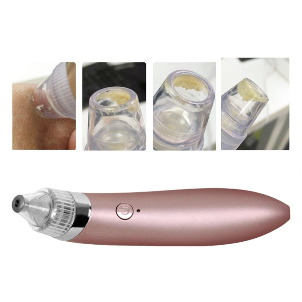 PACHET PROMOTIONAL!! APARAT DE TUNS SI CONTURAT CU Epilator Laser Innovation Touch TeleshopTV + CADOU !!!! APARAT VACUUM PRESURE CLEANER ORIGINAL TELESHOPTV CURATARE TEN