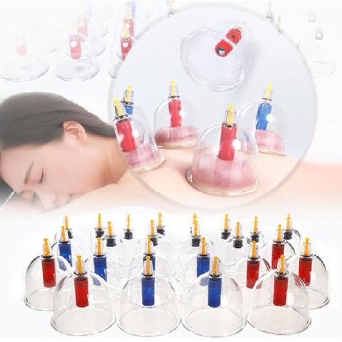 Set de 6 ventuze medicinale cu vacuum